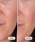 Bakuchiol Serum